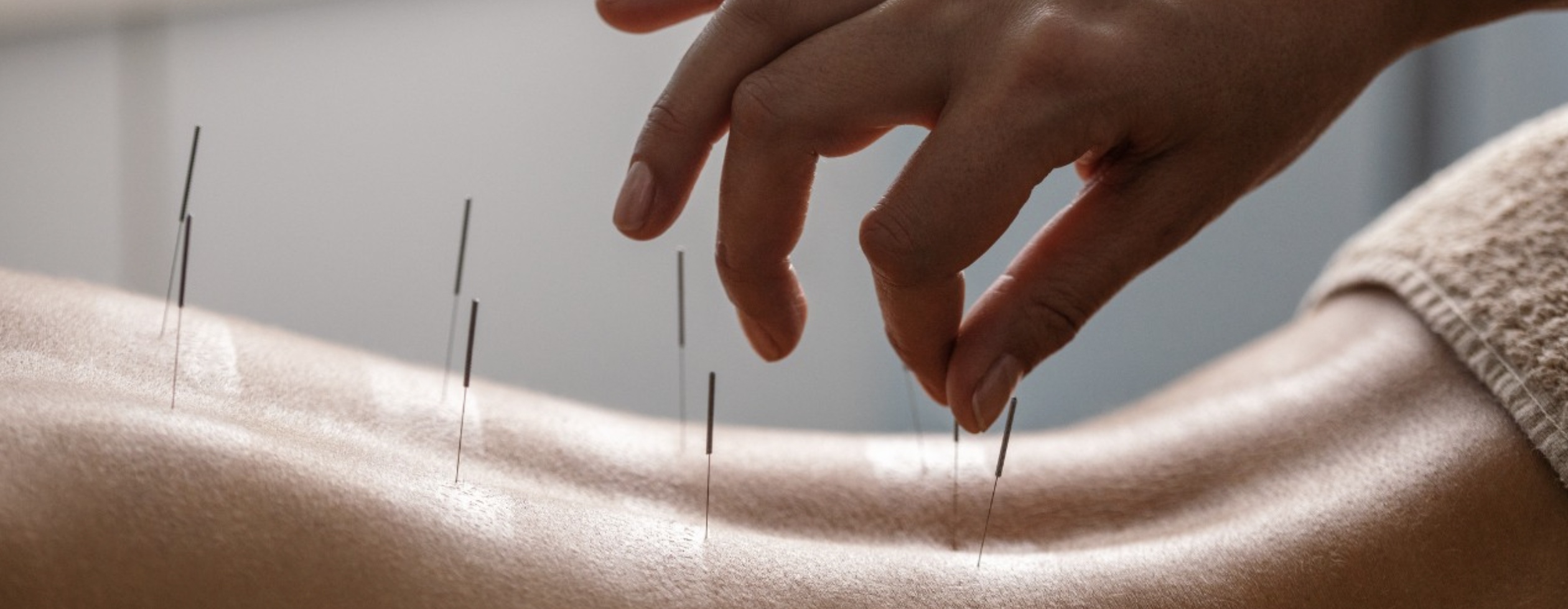 Dry Needling